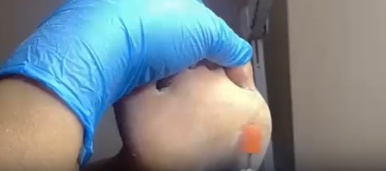 Medikal pedikür videosu önizleme